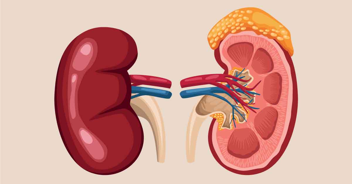 kidney realistic organs anatomy 경매, 공매, 경매와 공매 차이점, 경매 절차, 공매 절차, 부동산 경매, 부동산 공매, 경매 투자 전략, 공매 투자 전략, 경매 장단점, 공매 장단점, 경매 입찰 방법, 공매 입찰 방법, 자산 경매, 자산 공매, 경매 성공 사례, 공매 성공 사례, 경매 전문가 상담, 공매 법률, 부동산 투자 방법 신장암 4기 생존율, 20%의 희망을 찾는 법
